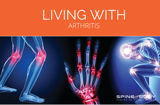 living with arthritis