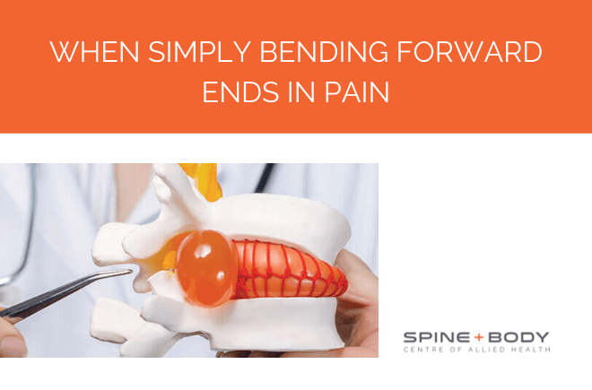When simply bending forward ends in pain | Spine and Body